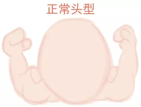ԲͷվɱͷЩ趼֪1.webp.jpg