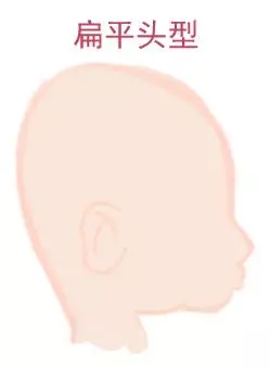 ԲͷվɱͷЩ趼֪4.webp.jpg