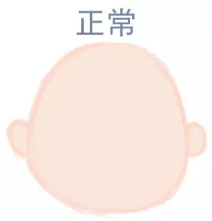 ԲͷվɱͷЩ趼֪5.webp.jpg
